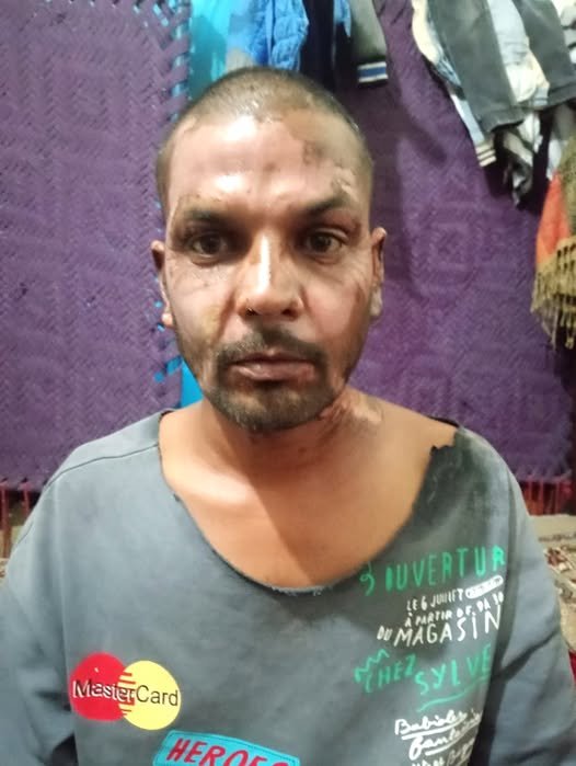 Muslim in Pakistan Sets Christian on Fire over Petty Dispute